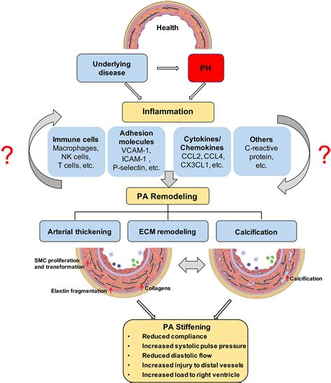 Sprycel (dasatinib) and risk of pulmonary arterial hypertension.